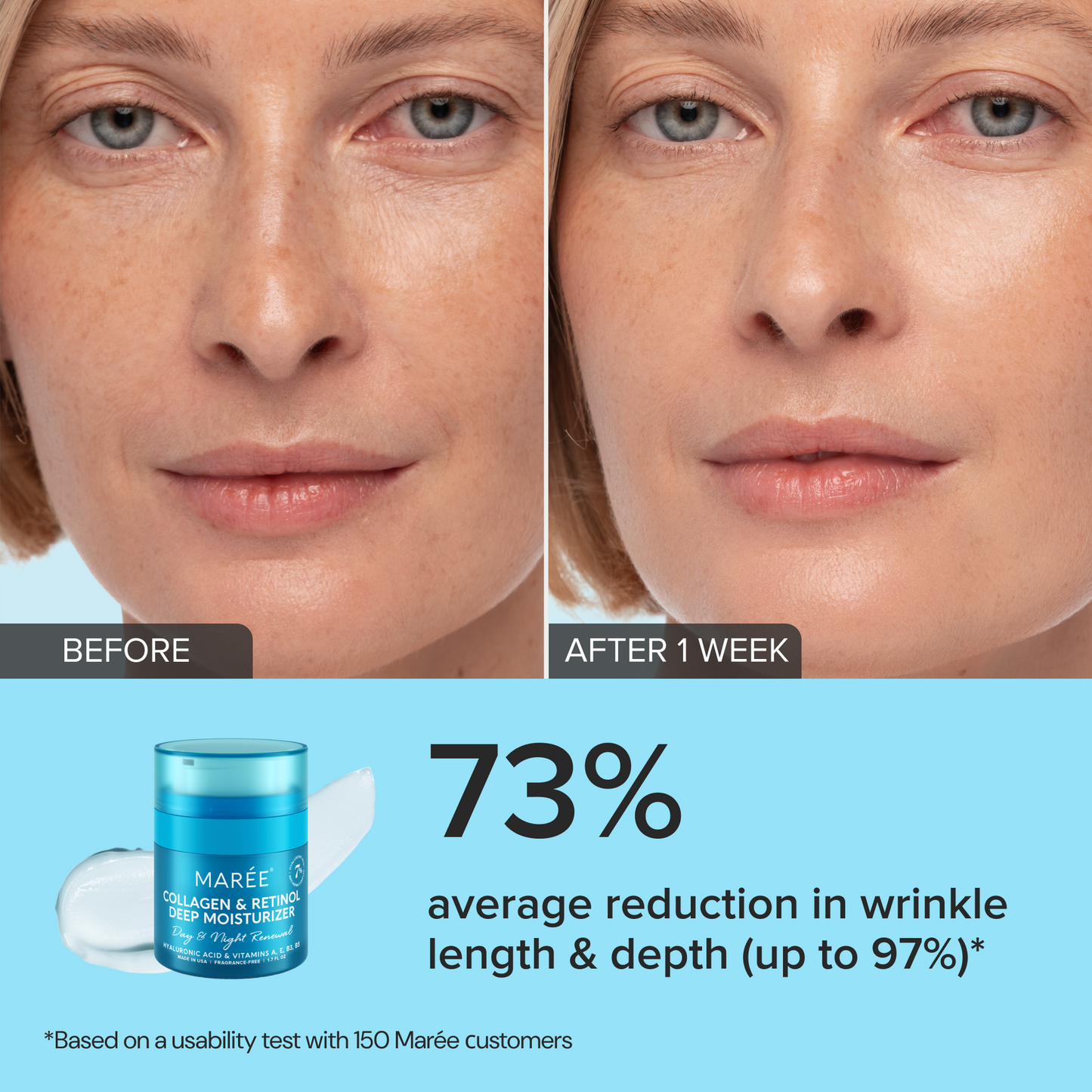 Retinol & Collagen Anti-Aging Face Cream – Retinol, Collagen & Hyaluronic Acid