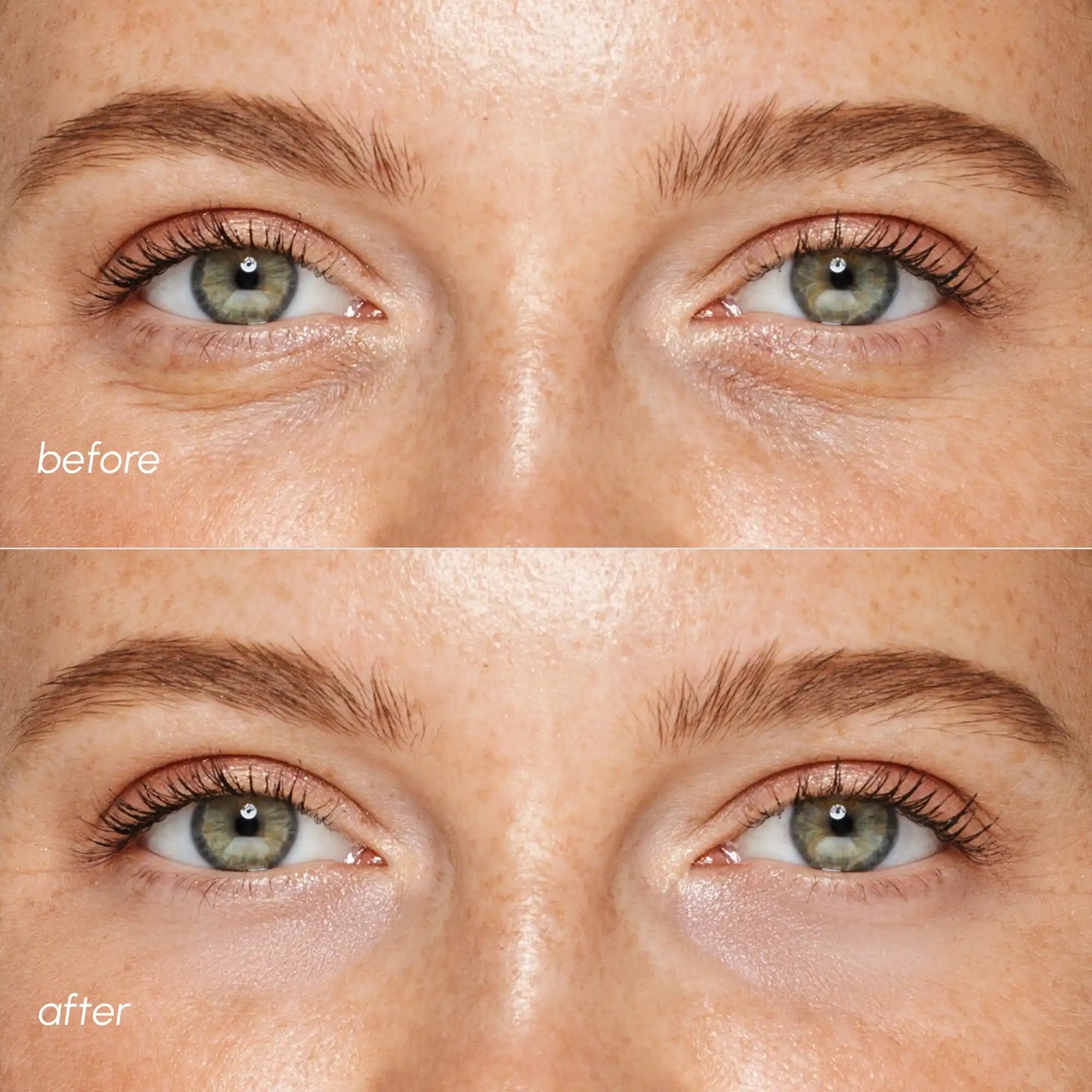 Pink Eye Patches for Puffy Eyes & Dark Circles