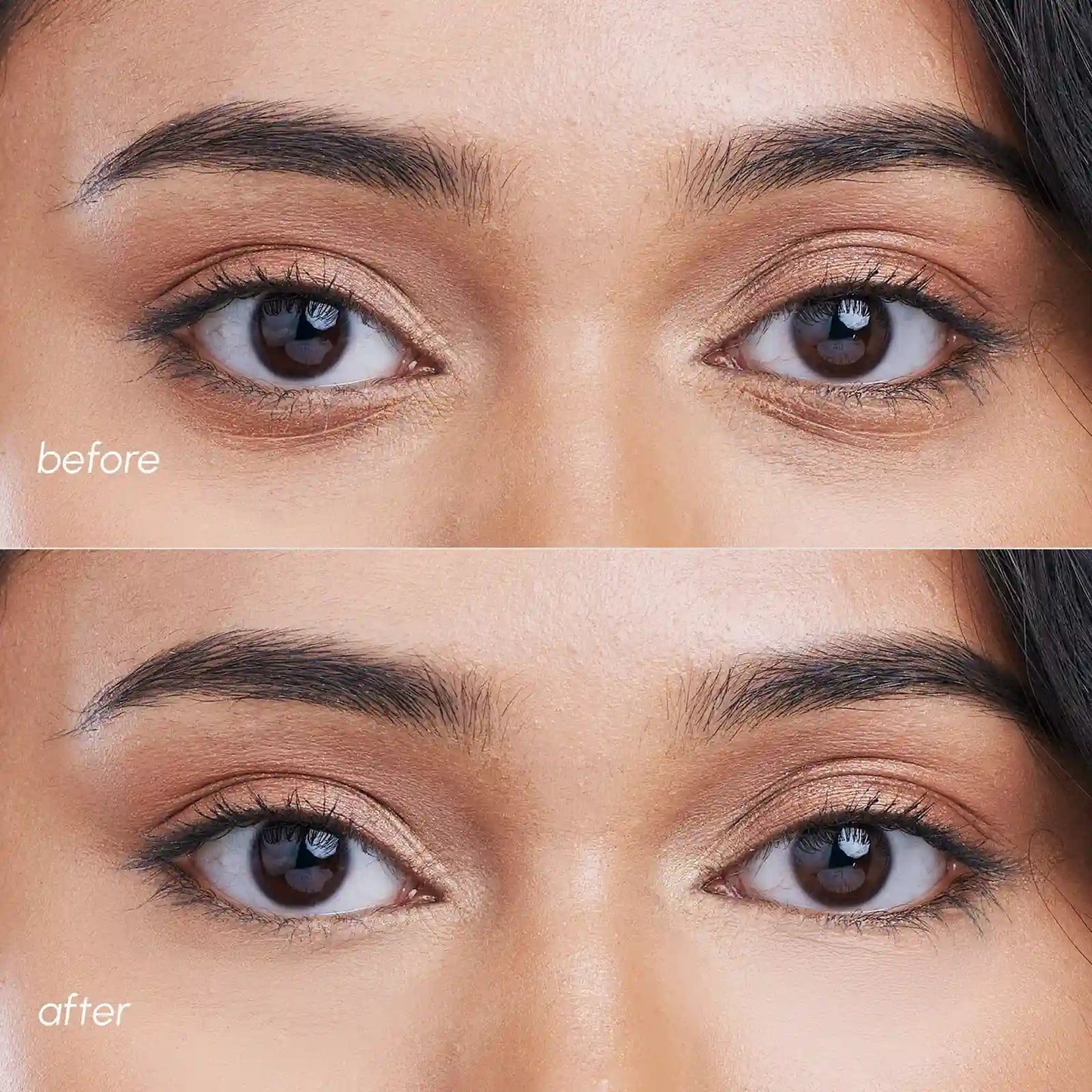 Pink Eye Patches for Puffy Eyes & Dark Circles