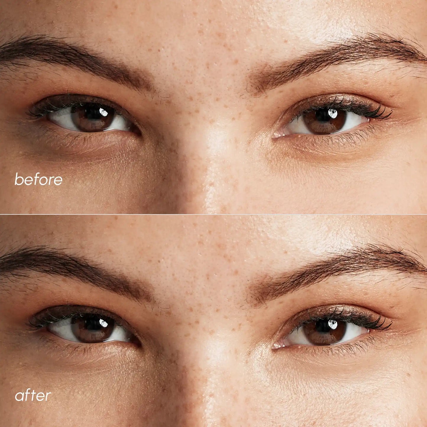 Pink Eye Patches for Puffy Eyes & Dark Circles