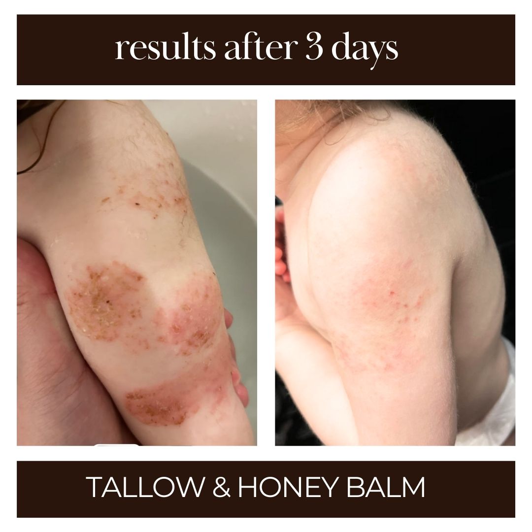 Tallow & Honey Balm | Multi-Use Healing Moisturizer