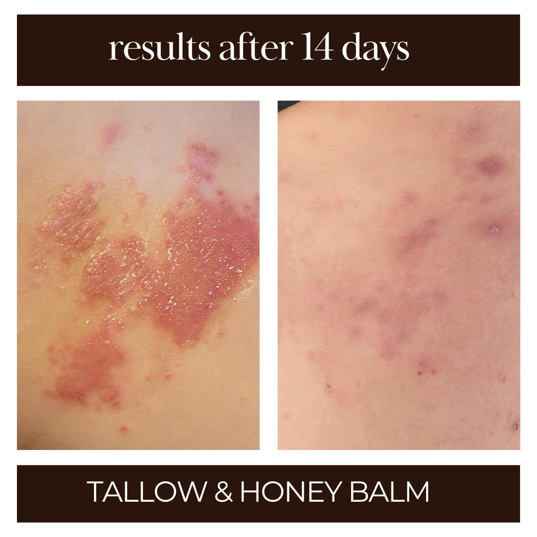 Tallow & Honey Balm | Multi-Use Healing Moisturizer