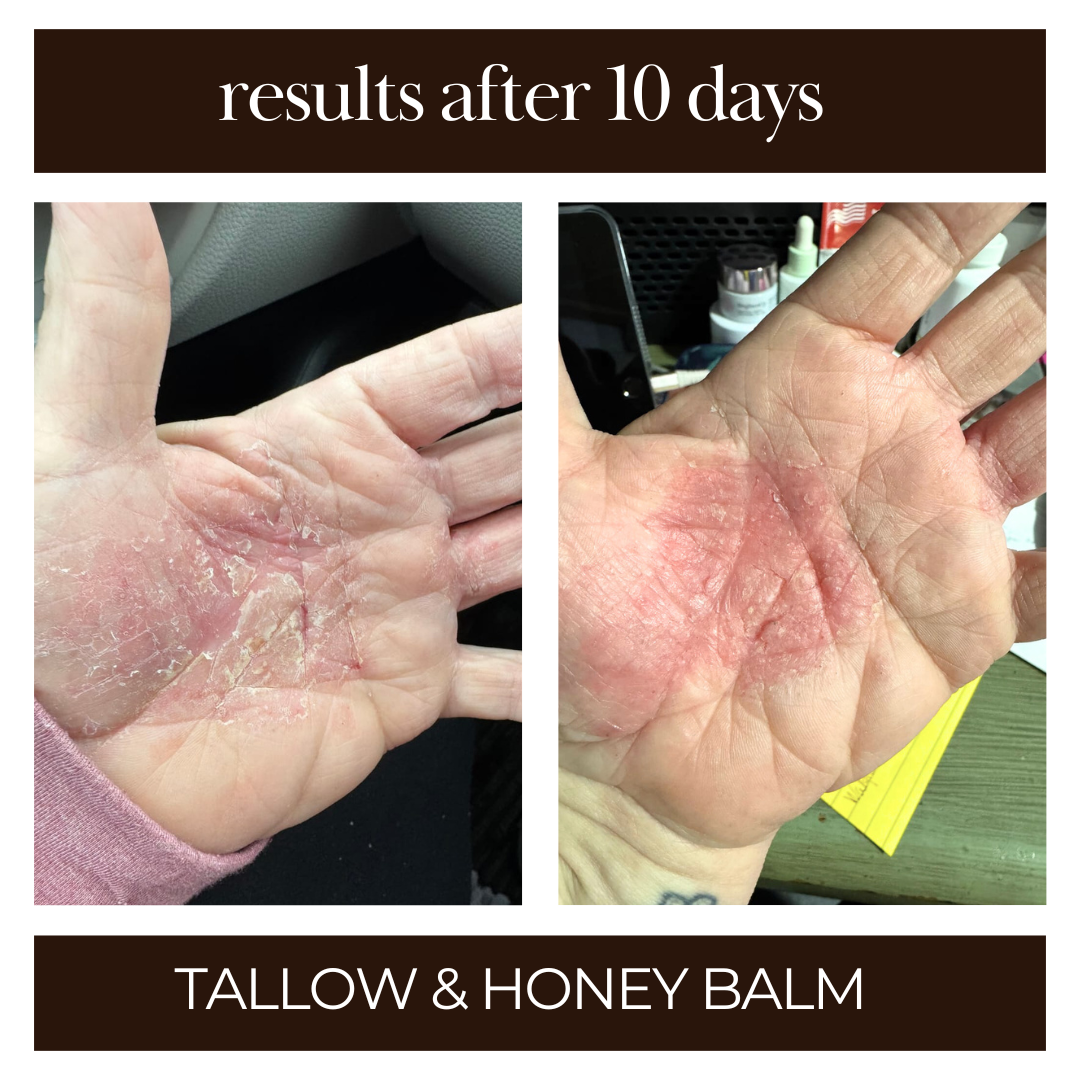 Tallow & Honey Balm | Multi-Use Healing Moisturizer