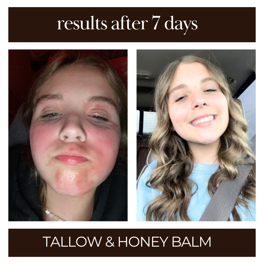 Tallow & Honey Balm | Multi-Use Healing Moisturizer
