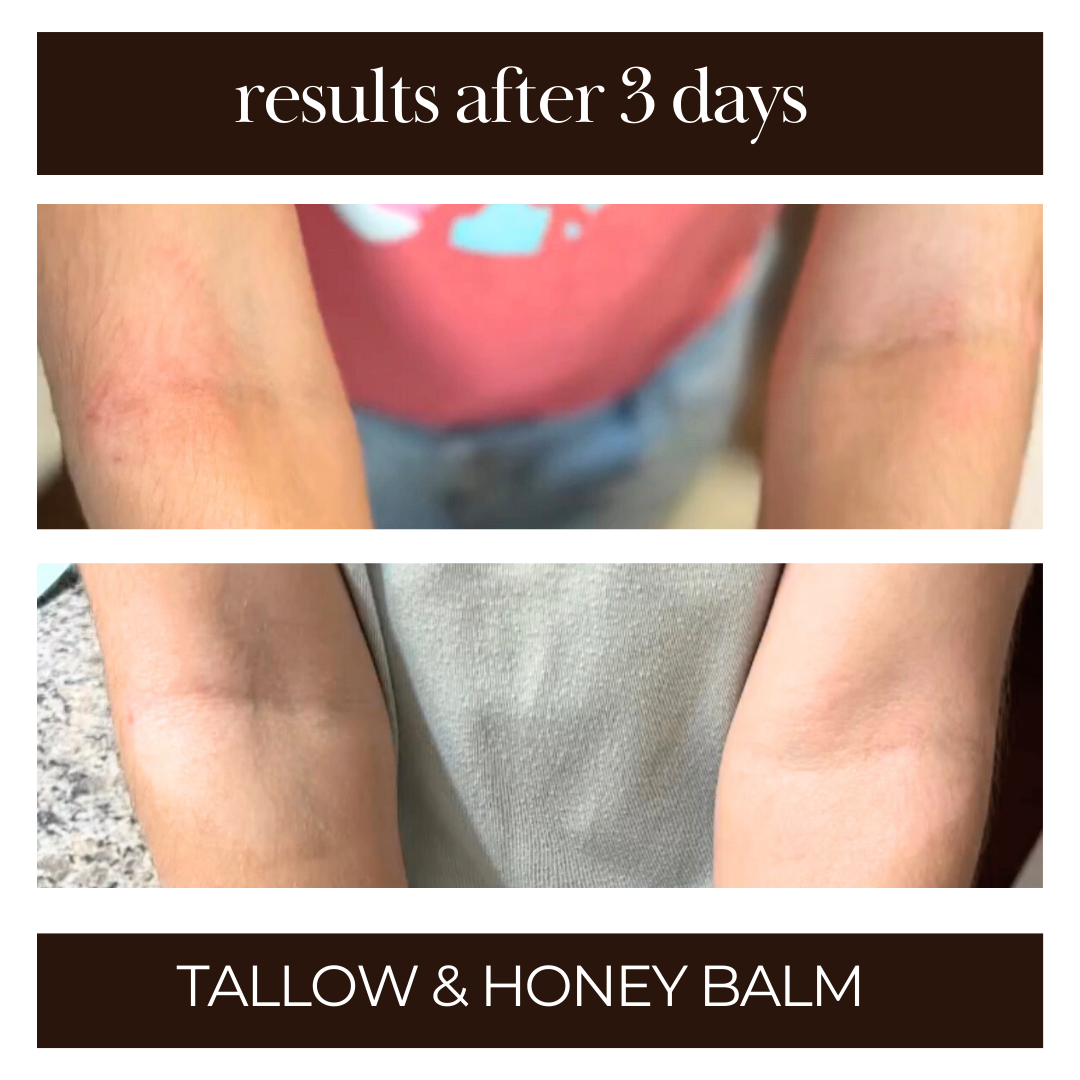 Tallow & Honey Balm | Multi-Use Healing Moisturizer