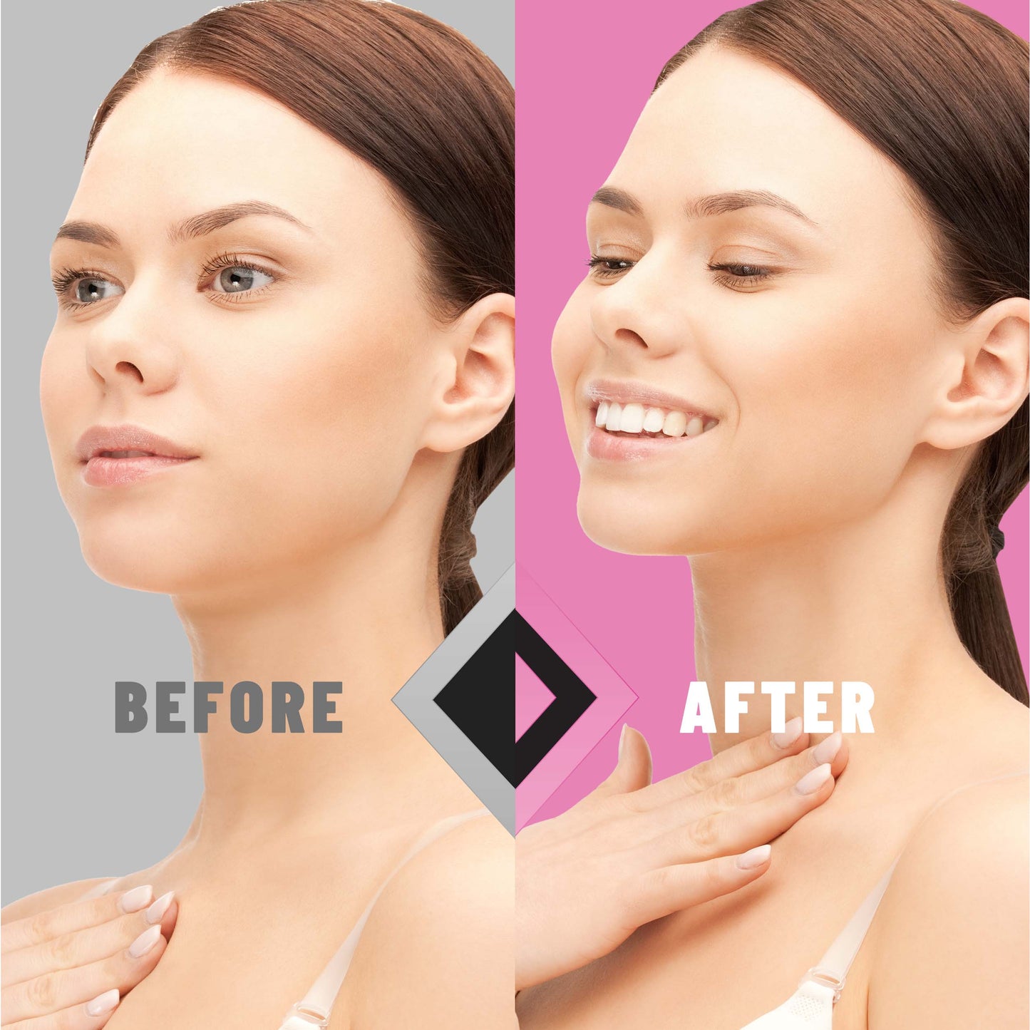 V-Line Lifting Mask by TOLEVITA – Jawline Sculpting & Hydrogel Treatment