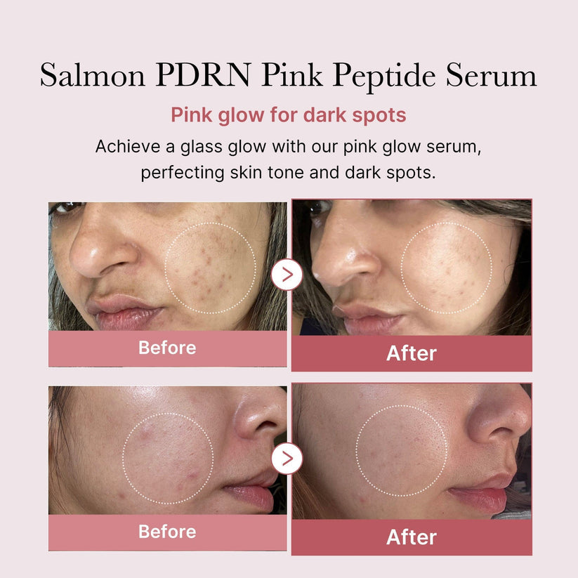 PDRN Pink Peptide Brightening Glow Serum | Collagen Hydrating & Firming Essence