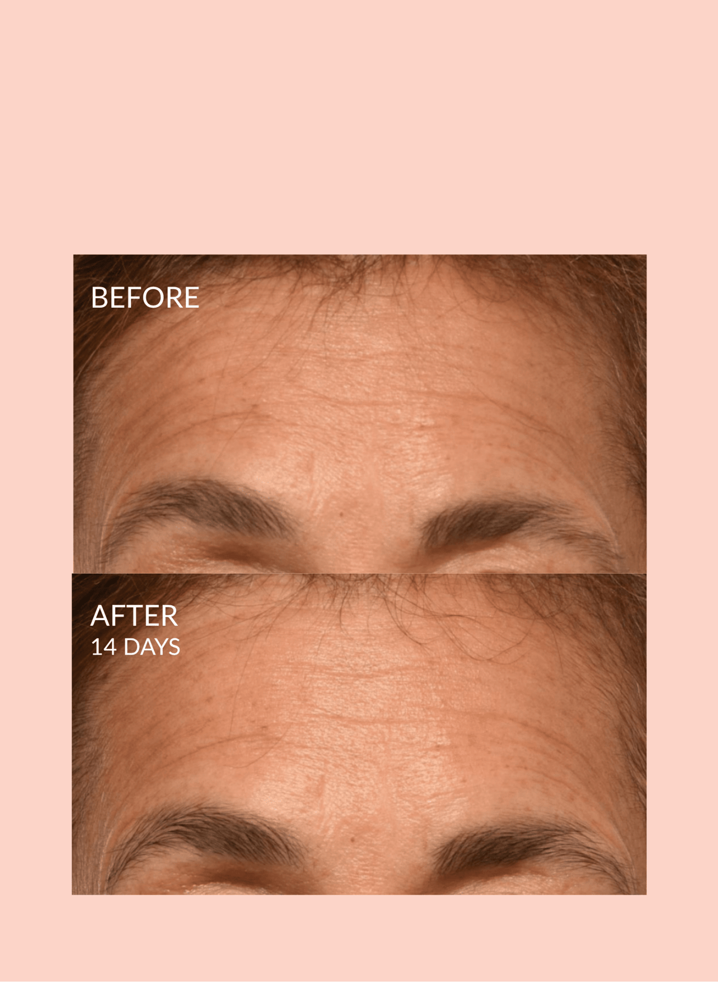Triple Lift Molecule Mask by Caire Beauty
